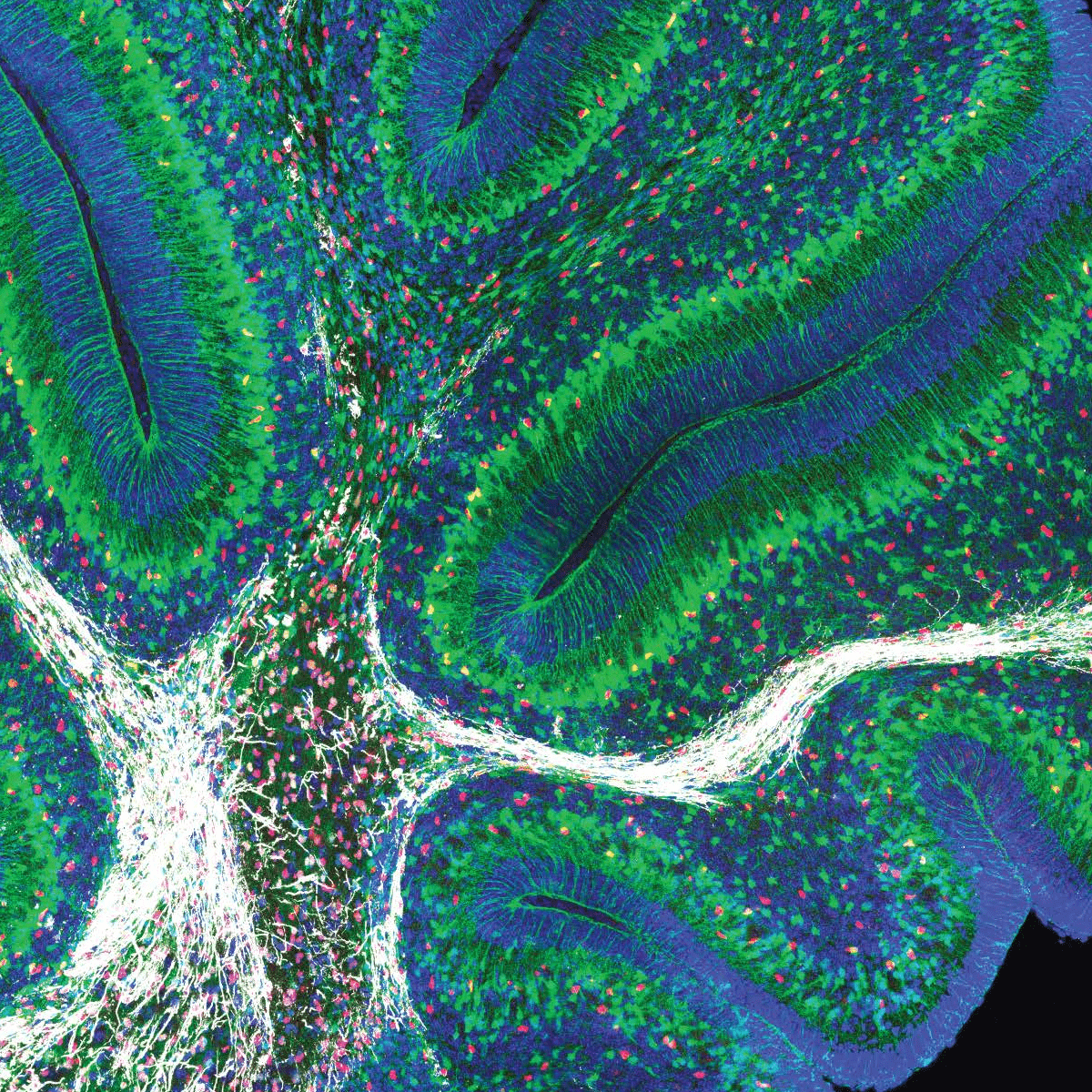 Neurons fluorescently labeled blue, green, and white